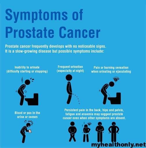 prostate-cancer prostate cancer